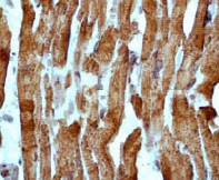 Immunohistochemistry (Formalin/PFA-fixed paraffin-embedded sections) - Anti-Cardiac Troponin I antibody [EP1106Y] - BSA and Azide free (AB182616)