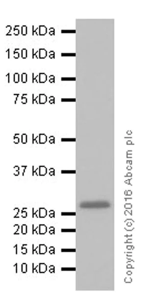Western blot - Anti-Cardiac Troponin I antibody [EPR20307] (AB209809)