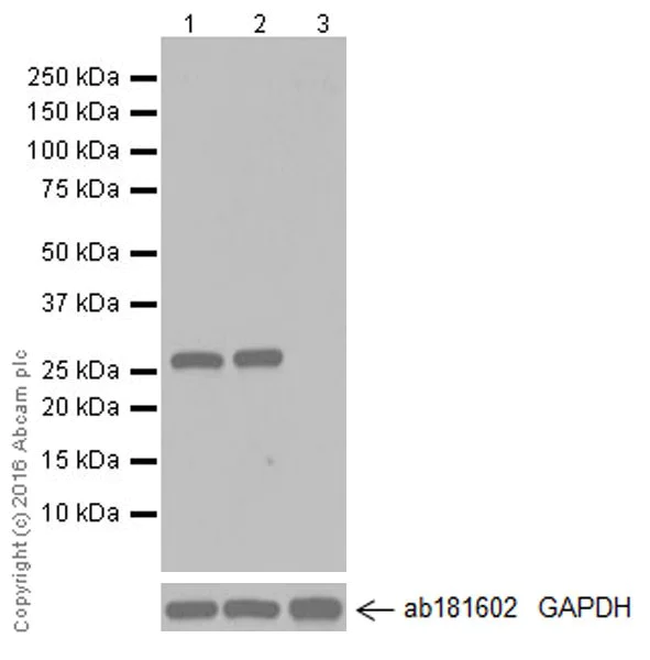 Western blot - Anti-Cardiac Troponin I antibody [EPR20307] (AB209809)