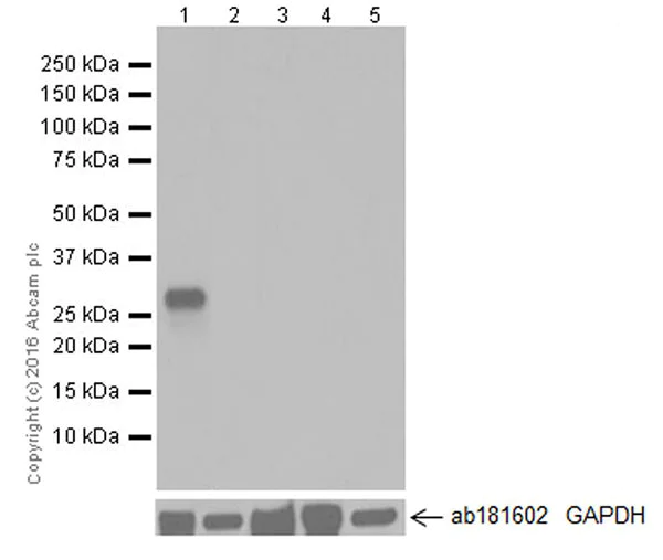 Western blot - Anti-Cardiac Troponin I antibody [EPR20307] (AB209809)
