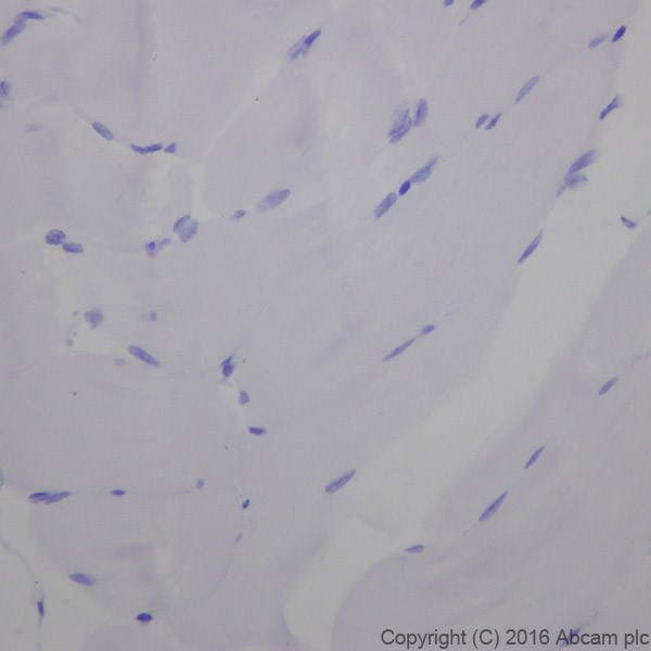 Immunohistochemistry (Formalin/PFA-fixed paraffin-embedded sections) - Anti-Cardiac Troponin I antibody [EPR20307] - BSA and Azide free (AB223149)