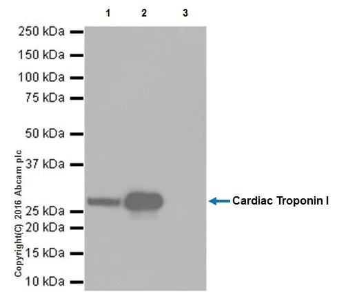 Immunoprecipitation - Anti-Cardiac Troponin I antibody [EPR20307] - BSA and Azide free (AB223149)