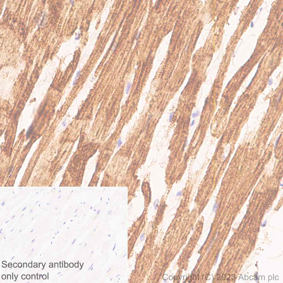 Immunohistochemistry (Formalin/PFA-fixed paraffin-embedded sections) - Anti-Cardiac Troponin I antibody [RM1073] (ab314912), expandable thumbnail