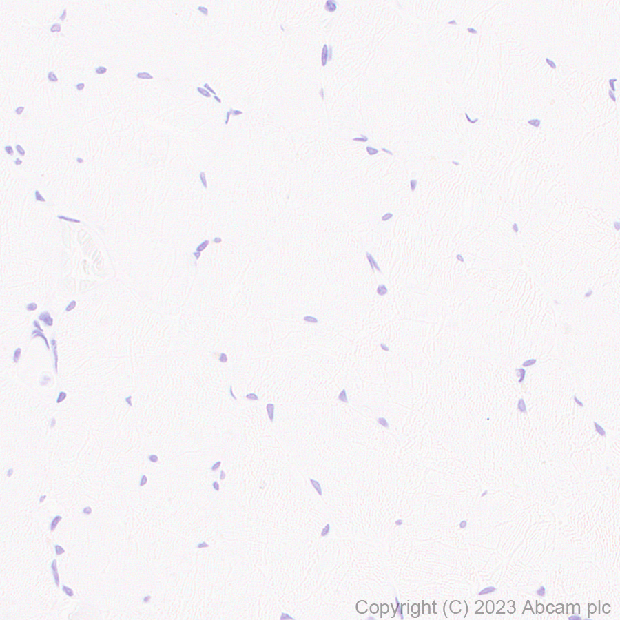 Immunohistochemistry (Formalin/PFA-fixed paraffin-embedded sections) - Anti-Cardiac Troponin I antibody [RM1073] (ab314912), expandable thumbnail