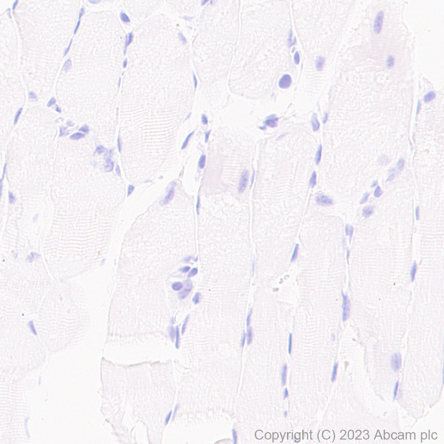 Immunohistochemistry (Formalin/PFA-fixed paraffin-embedded sections) - Anti-Cardiac Troponin I antibody [RM1073] (ab314912), expandable thumbnail