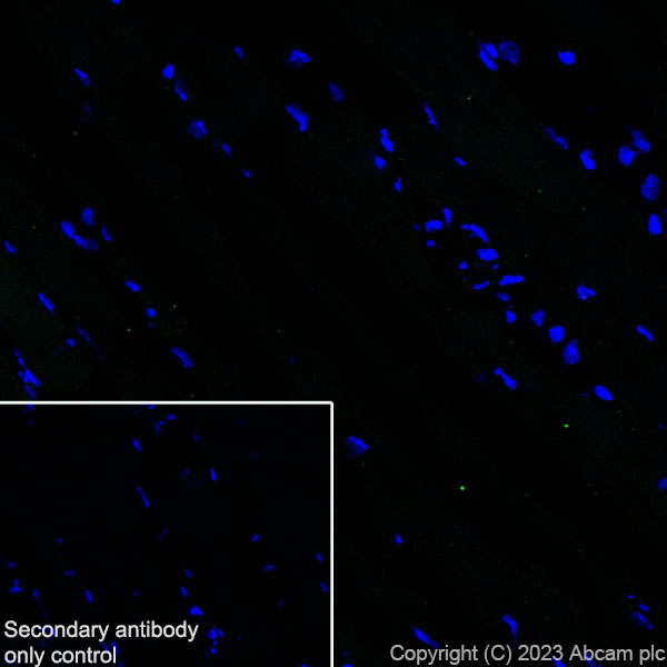 Immunohistochemistry (Frozen sections) - Anti-Cardiac Troponin I antibody [RM1073] (AB314912), expandable thumbnail