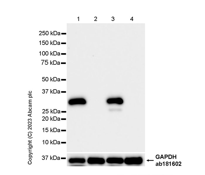 Western blot - Anti-Cardiac Troponin I antibody [RM1073] (ab314912), expandable thumbnail