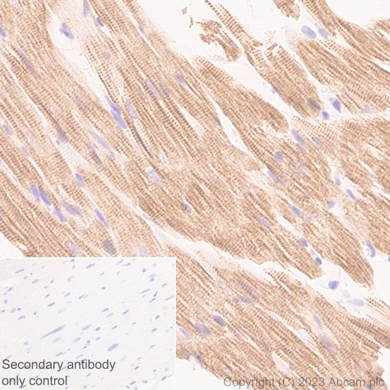Immunohistochemistry (Formalin/PFA-fixed paraffin-embedded sections) - Anti-Cardiac Troponin I antibody [RM1073] - BSA and Azide free (AB314913)