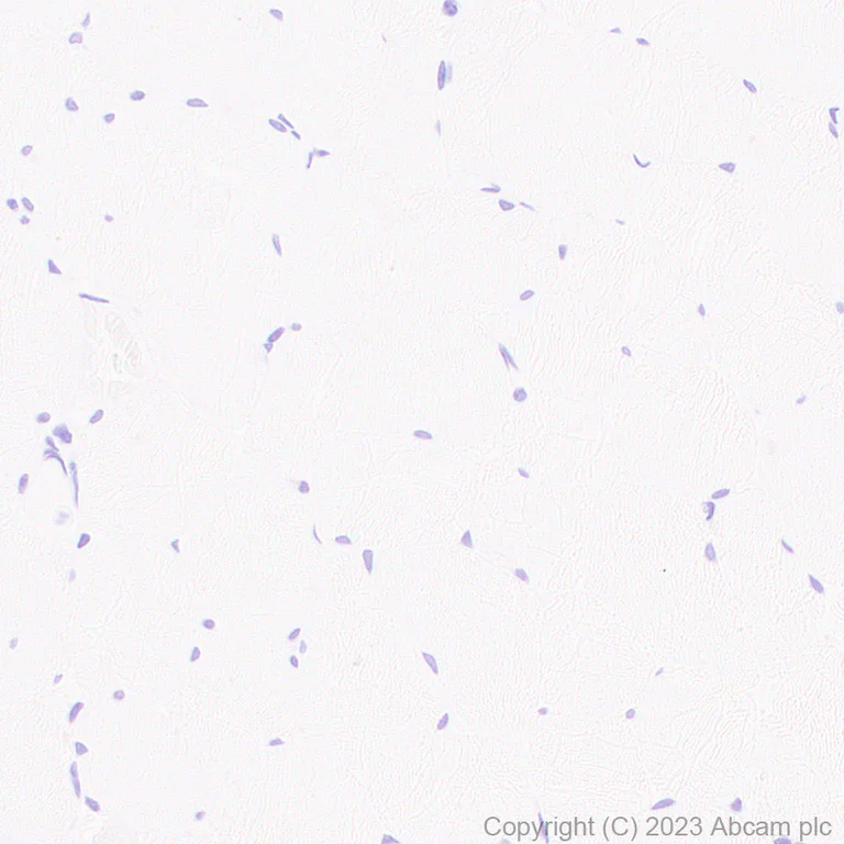 Immunohistochemistry (Formalin/PFA-fixed paraffin-embedded sections) - Anti-Cardiac Troponin I antibody [RM1073] - BSA and Azide free (AB314913)