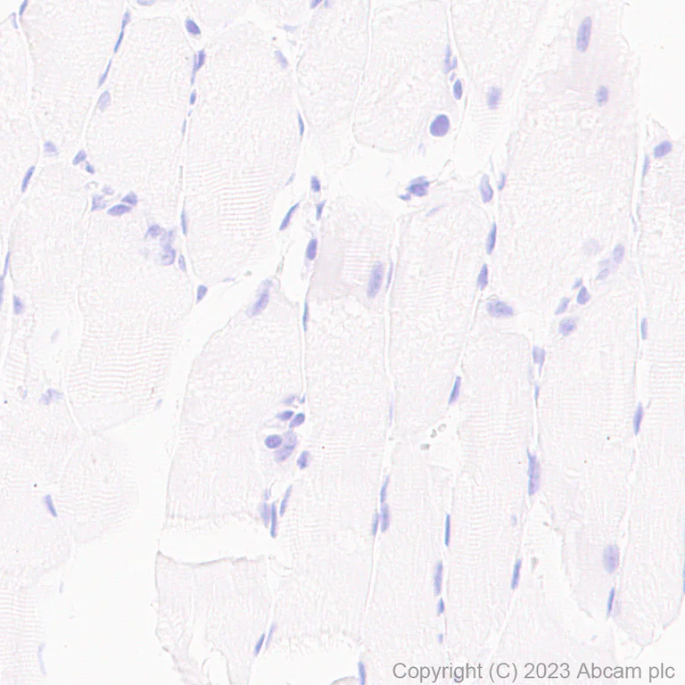Immunohistochemistry (Formalin/PFA-fixed paraffin-embedded sections) - Anti-Cardiac Troponin I antibody [RM1073] - BSA and Azide free (AB314913)