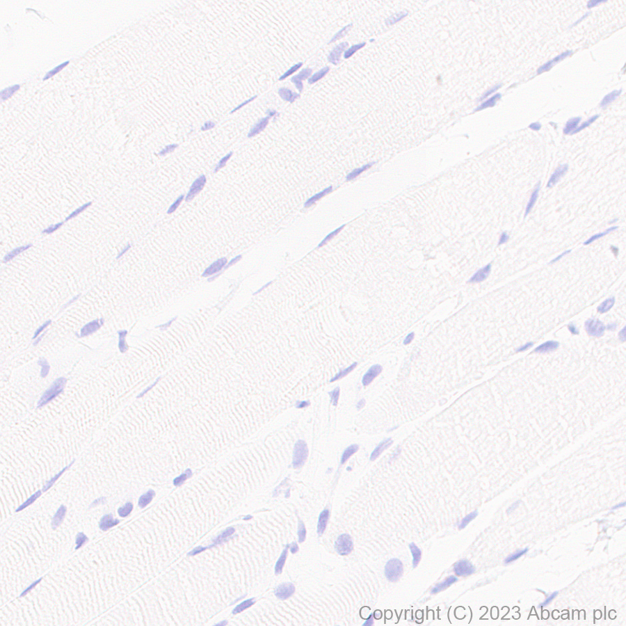 Immunohistochemistry (Formalin/PFA-fixed paraffin-embedded sections) - Anti-Cardiac Troponin I antibody [RM1073] - BSA and Azide free (AB314913), expandable thumbnail