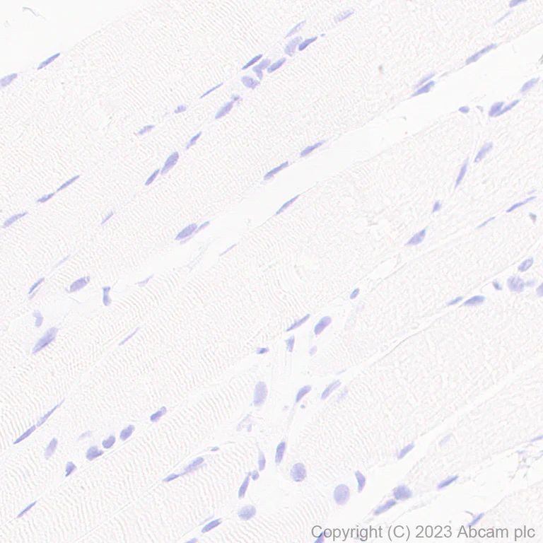 Immunohistochemistry (Formalin/PFA-fixed paraffin-embedded sections) - Anti-Cardiac Troponin I antibody [RM1073] - BSA and Azide free (AB314913)
