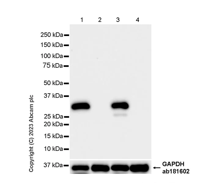 Western blot - Anti-Cardiac Troponin I antibody [RM1073] - BSA and Azide free (AB314913)