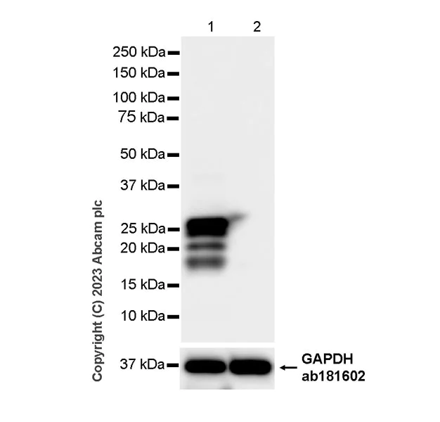 Western blot - Anti-Cardiac Troponin I antibody [RM1073] - BSA and Azide free (AB314913)
