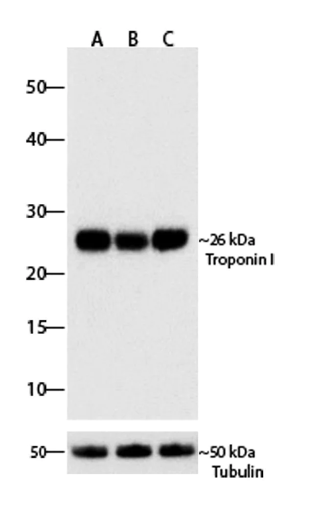 Western blot - Anti-Cardiac Troponin I Antibody [RP23040093] (AB313411)