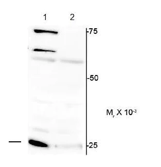 Western blot - Anti-Cardiac Troponin I (phospho S150) antibody (AB169867)