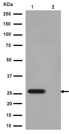 Western blot - Anti-Cardiac Troponin I (phospho S22 + S23) antibody [EPR1059(2)] (AB190697)