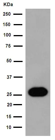Western blot - Anti-Cardiac Troponin I (phospho S22 + S23) antibody [EPR1059(2)] (AB190697)