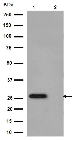 Western blot - Anti-Cardiac Troponin I (phospho S22 + S23) antibody [EPR1059(2)] - BSA and Azide free (AB251031)