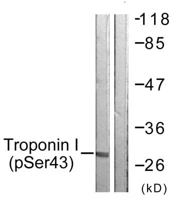 Western blot - Anti-cardiac Troponin I (phospho S43) antibody (AB59420)