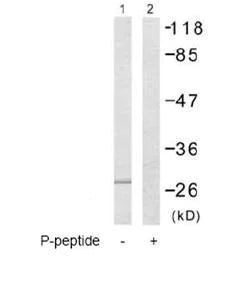 Western blot - Anti-Cardiac Troponin I (phospho T143) antibody (AB58546)