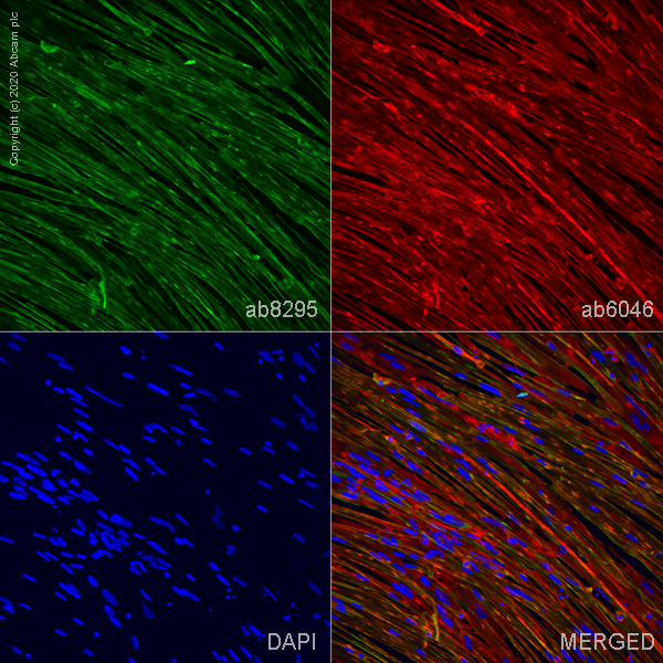 Immunocytochemistry - Anti-Cardiac Troponin T antibody [1C11] (AB8295), expandable thumbnail