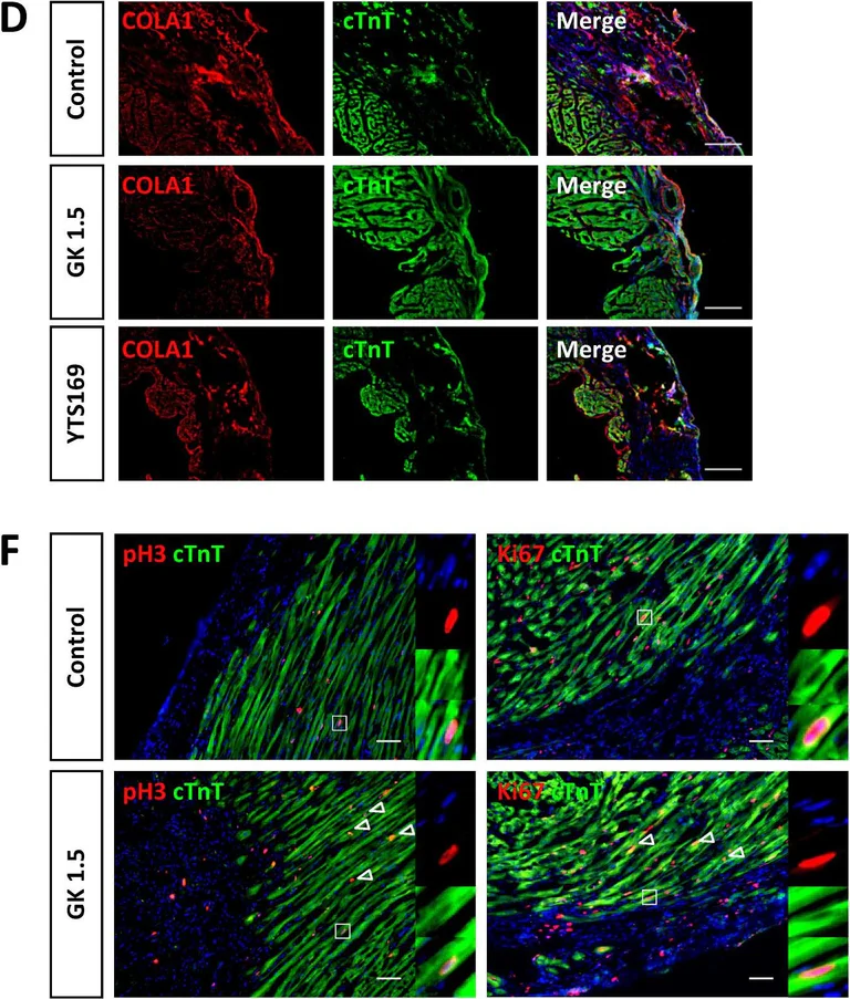 Immunocytochemistry/ Immunofluorescence - Anti-Cardiac Troponin T antibody [1C11] (AB8295)