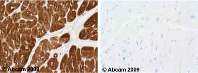 Immunohistochemistry (Formalin/PFA-fixed paraffin-embedded sections) - Anti-Cardiac Troponin T antibody [1C11] (AB8295), expandable thumbnail
