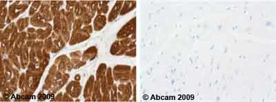 Immunohistochemistry (Formalin/PFA-fixed paraffin-embedded sections) - Anti-Cardiac Troponin T antibody [1C11] (AB8295)