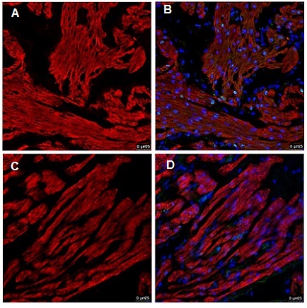 Immunohistochemistry (Formalin/PFA-fixed paraffin-embedded sections) - Anti-Cardiac Troponin T antibody [1C11] (AB8295), expandable thumbnail