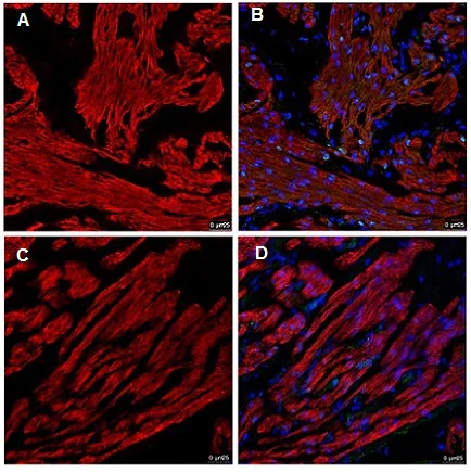 Immunohistochemistry (Formalin/PFA-fixed paraffin-embedded sections) - Anti-Cardiac Troponin T antibody [1C11] (AB8295)