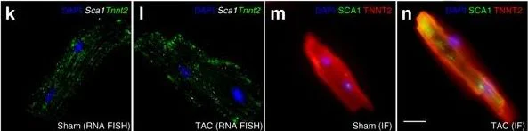 Immunohistochemistry - Anti-Cardiac Troponin T antibody [1C11] (AB8295)