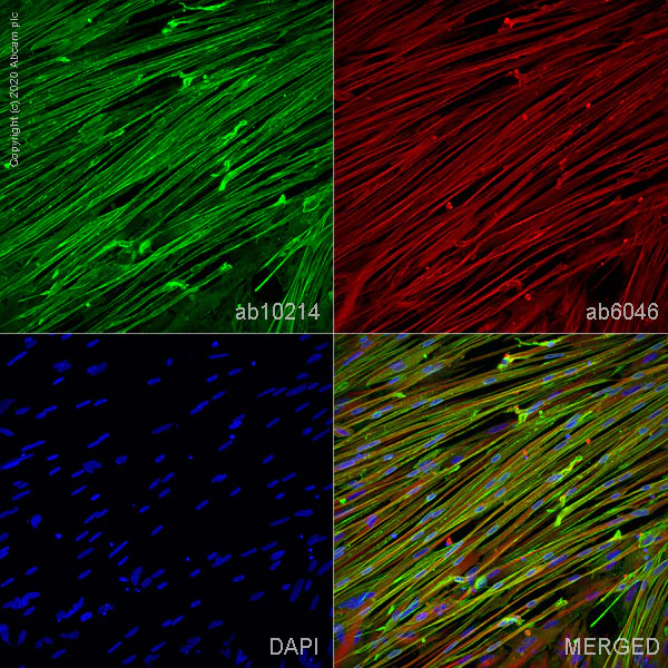 Immunocytochemistry - Anti-Cardiac Troponin T antibody [1F11] (AB10214)