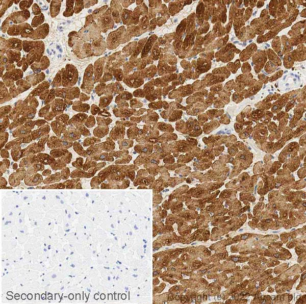 Immunohistochemistry (Formalin/PFA-fixed paraffin-embedded sections) - Anti-Cardiac Troponin T antibody (AB45932)