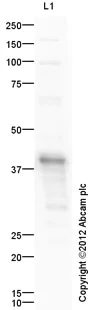 Western blot - Anti-Cardiac Troponin T antibody (AB45932)
