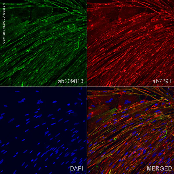 Immunocytochemistry/ Immunofluorescence - Anti-Cardiac Troponin T antibody [EPR20266] (AB209813)