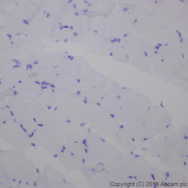 Immunohistochemistry (Formalin/PFA-fixed paraffin-embedded sections) - Anti-Cardiac Troponin T antibody [EPR20266] - BSA and Azide free (AB223536), expandable thumbnail