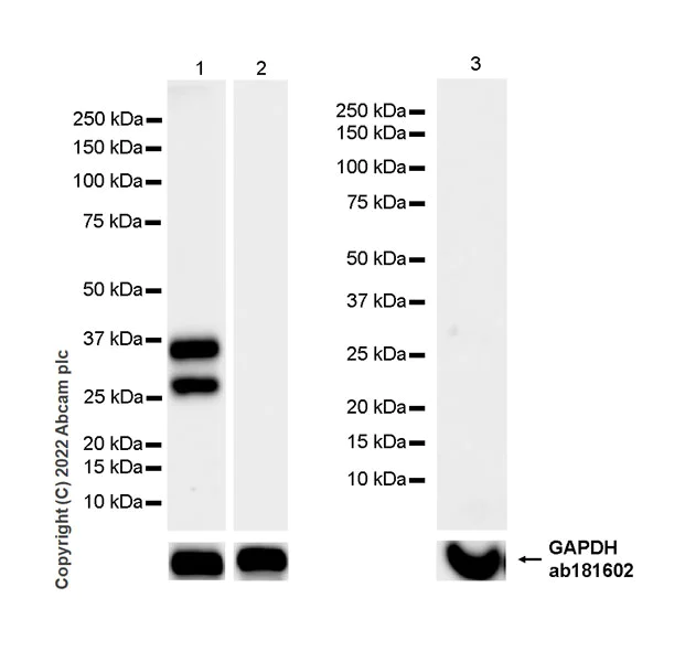 Western blot - Anti-Cardiac Troponin T antibody [EPR26703-8] (AB307152)