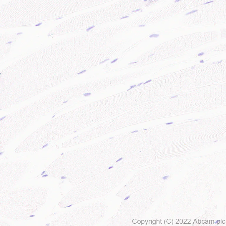 Immunohistochemistry - Anti-Cardiac Troponin T antibody [EPR26703-8] - BSA and Azide free (AB307153)