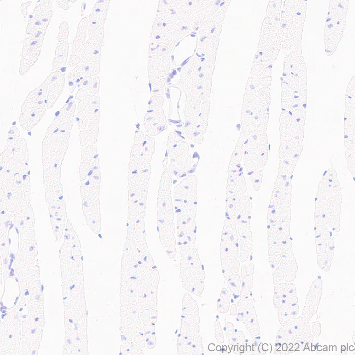 Immunohistochemistry - Anti-Cardiac Troponin T antibody [EPR26703-8] - BSA and Azide free (AB307153)