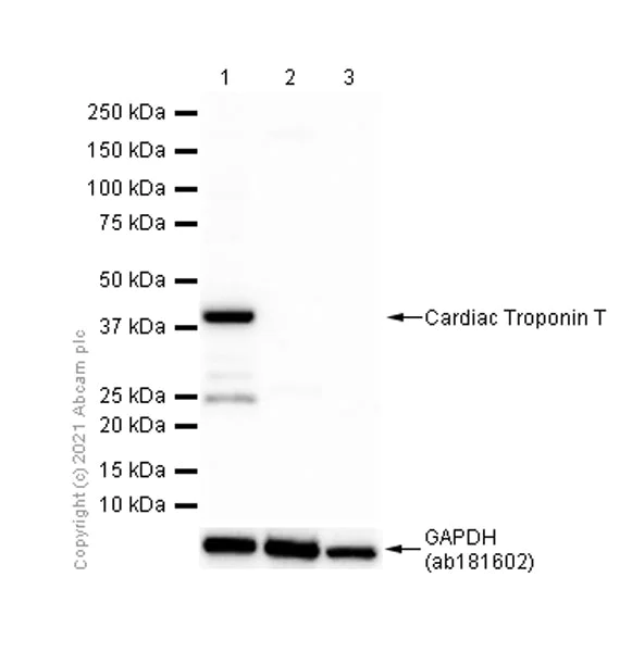 Western blot - Anti-Cardiac Troponin T antibody [EPR3695] - BSA and Azide free (AB247526)