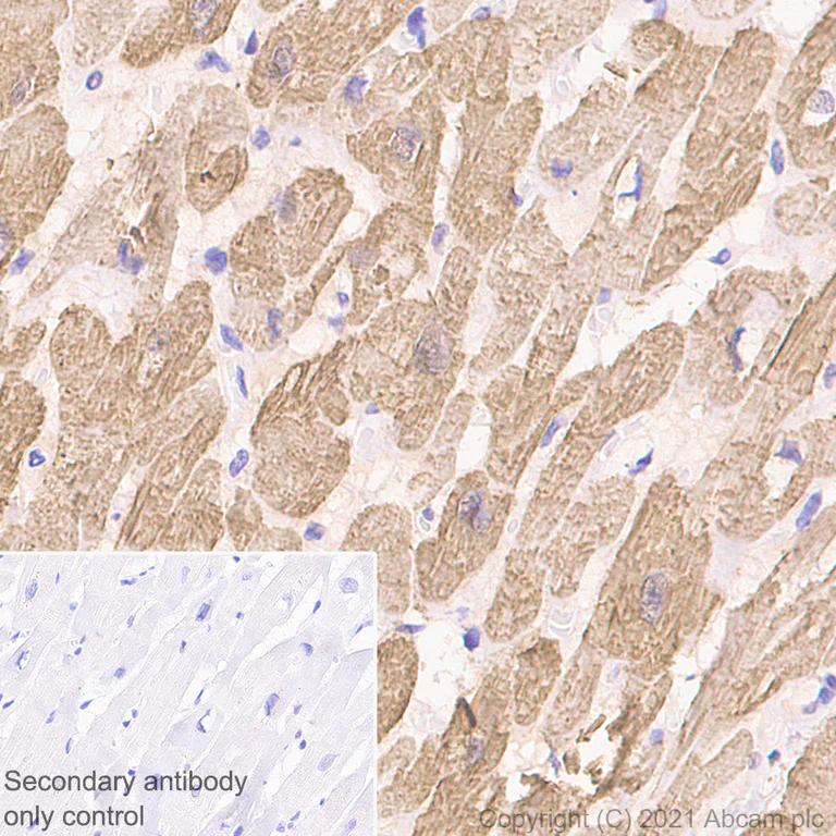 Immunohistochemistry (Formalin/PFA-fixed paraffin-embedded sections) - Anti-Cardiac Troponin T antibody [EPR3696] (AB92546)