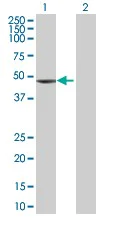 Western blot - Cardiac Troponin T overexpression 293T lysate (whole cell) (AB94042)