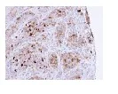 Immunohistochemistry (Formalin/PFA-fixed paraffin-embedded sections) - Anti-CARHSP1 antibody (AB96677)