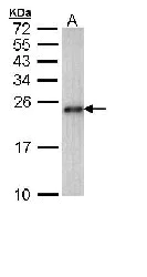 Western blot - Anti-CARHSP1 antibody (AB96677)