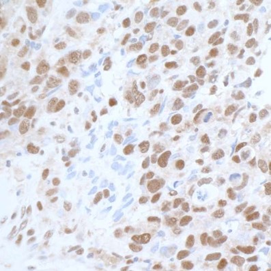 Immunohistochemistry (Formalin/PFA-fixed paraffin-embedded sections) - Anti-CARM1 antibody (AB245467)