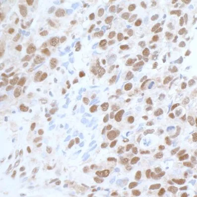 Immunohistochemistry (Formalin/PFA-fixed paraffin-embedded sections) - Anti-CARM1 antibody (AB245467)