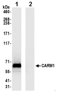Immunoprecipitation - Anti-CARM1 antibody (AB245467)
