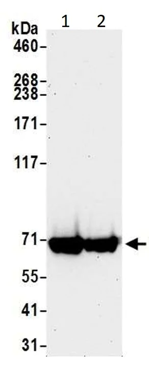 Western blot - Anti-CARM1 antibody (AB245467)