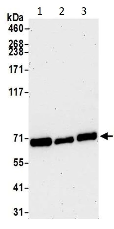 Western blot - Anti-CARM1 antibody (AB245467)